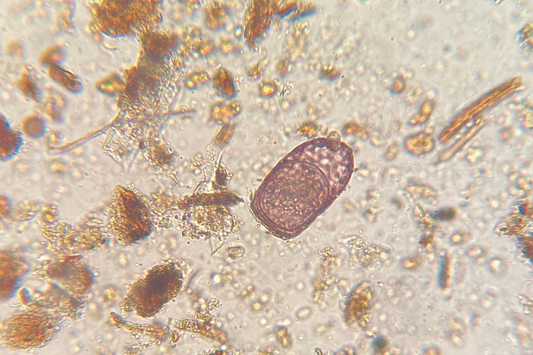 Amoeba found in soil food web compost, essential for soil health and microbial activity in organic gardening.